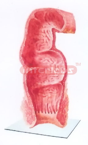 HUMAN HEALTH RECTUM (CORONAL SECTION) MODEL